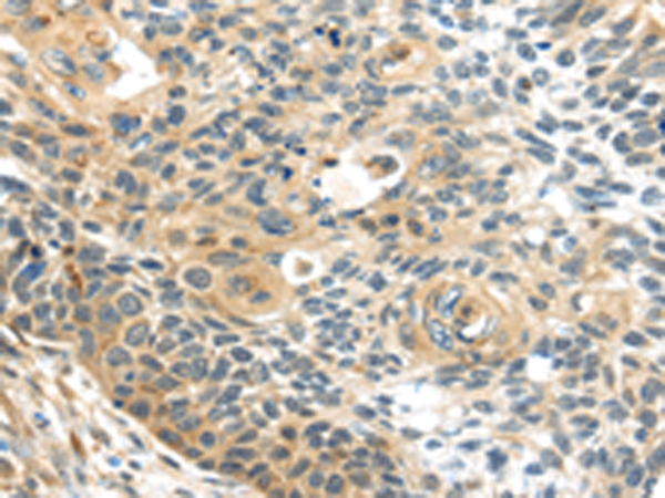 Anti-SESN3 Rabbit Polyclonal Antibody