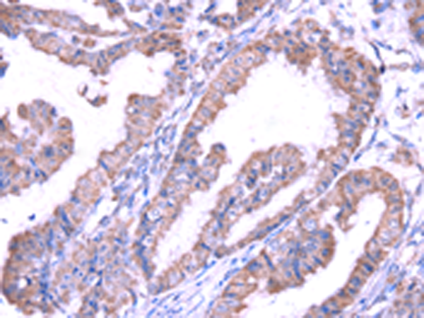 Anti-SRPK1 Rabbit Polyclonal Antibody
