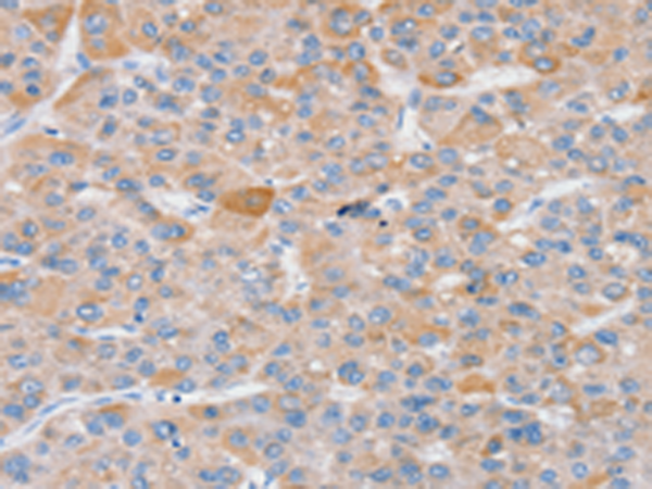 Anti-SLC25A13 Rabbit Polyclonal Antibody