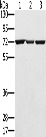 Anti-SLC25A13 Rabbit Polyclonal Antibody