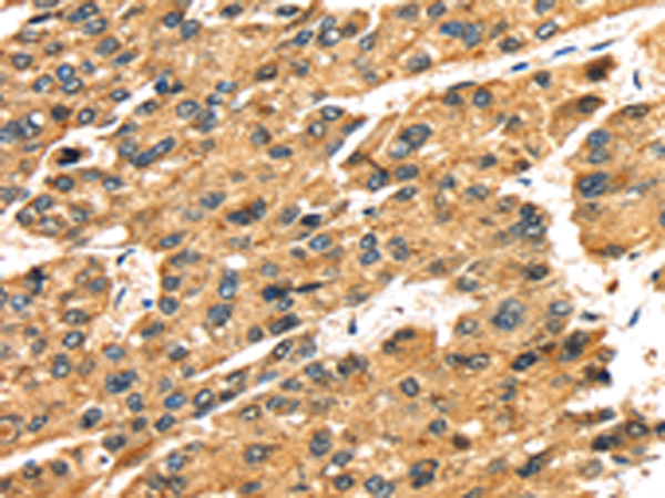 Anti-SLC25A26 Rabbit Polyclonal Antibody