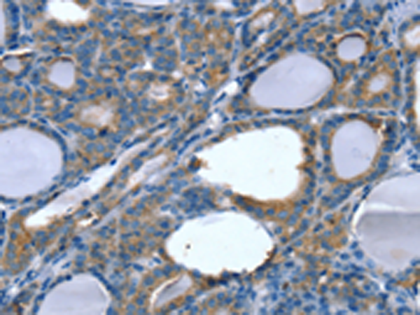 Anti-SLITRK4 Rabbit Polyclonal Antibody