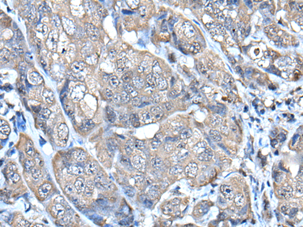 Anti-HELLS Rabbit Polyclonal Antibody