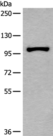 Anti-HELLS Rabbit Polyclonal Antibody