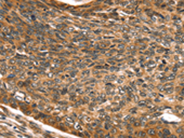 Anti-SKIL Rabbit Polyclonal Antibody