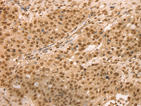 Anti-SNX8 Rabbit Polyclonal Antibody