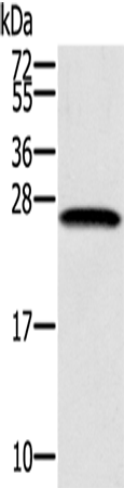 Anti-SSX1 Rabbit Polyclonal Antibody