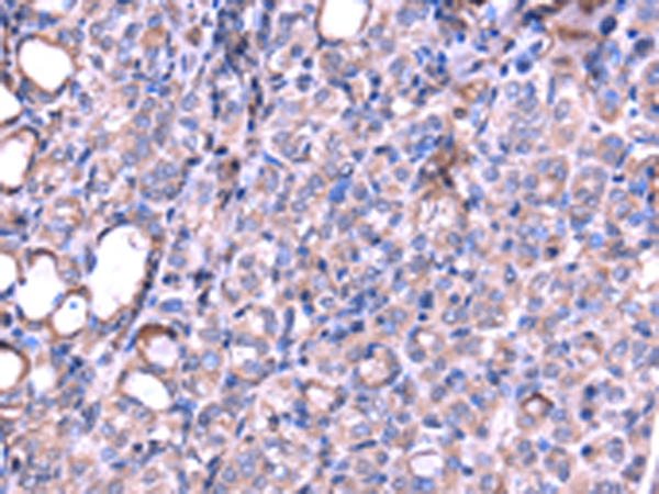 Anti-SRPK3 Rabbit Polyclonal Antibody