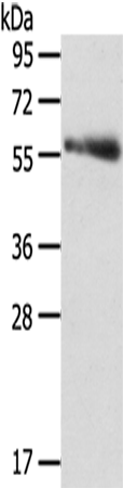 Anti-SRPK3 Rabbit Polyclonal Antibody