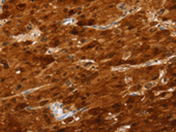 Anti-Sulfotransferase 2A1 Rabbit Polyclonal Antibody