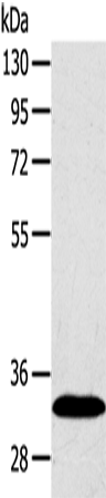 Anti-Sulfotransferase 2A1 Rabbit Polyclonal Antibody