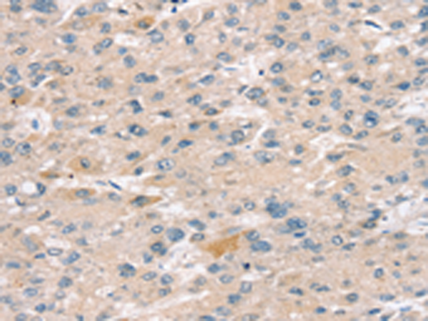 Anti-Sulfotransferase 2B1 Rabbit Polyclonal Antibody