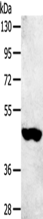 Anti-Sulfotransferase 2B1 Rabbit Polyclonal Antibody
