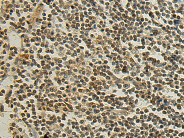Anti-Surfeit Locus Protein 6 Rabbit Polyclonal Antibody