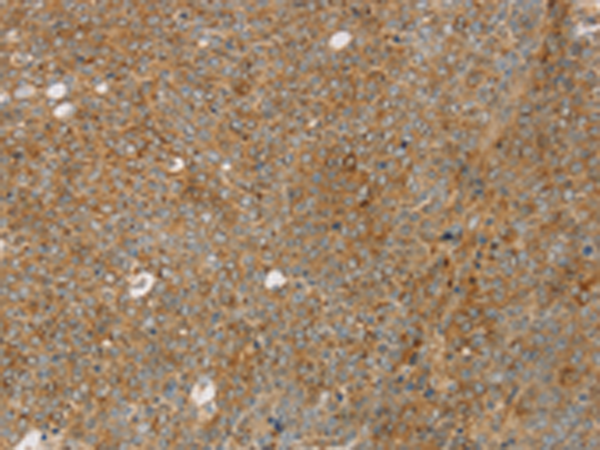Anti-Syntaxin 16 Rabbit Polyclonal Antibody