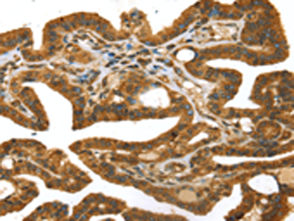 Anti-STX11 Rabbit Polyclonal Antibody