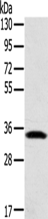 Anti-STX11 Rabbit Polyclonal Antibody