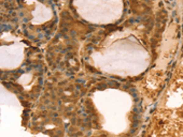 Anti-TAF11 Rabbit Polyclonal Antibody