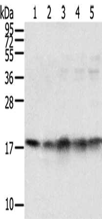 Anti-TAF11 Rabbit Polyclonal Antibody
