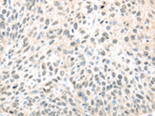 Anti-ELOC Rabbit Polyclonal Antibody