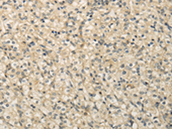 Anti-RASD2 Rabbit Polyclonal Antibody
