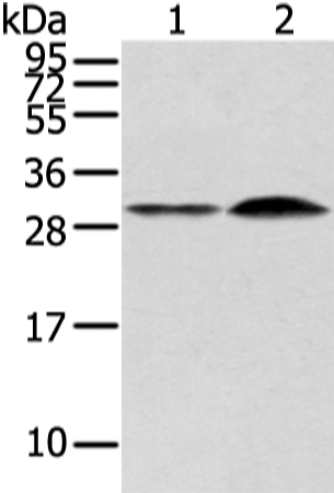 Anti-RASD2 Rabbit Polyclonal Antibody