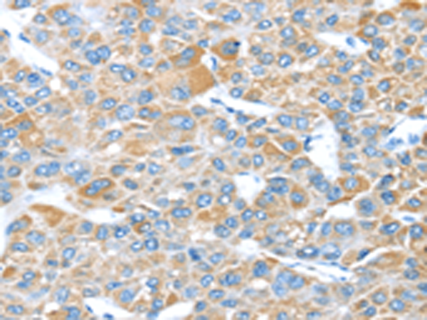 Anti-LEFTY2 Rabbit Polyclonal Antibody