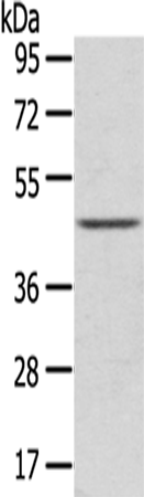 Anti-LEFTY2 Rabbit Polyclonal Antibody