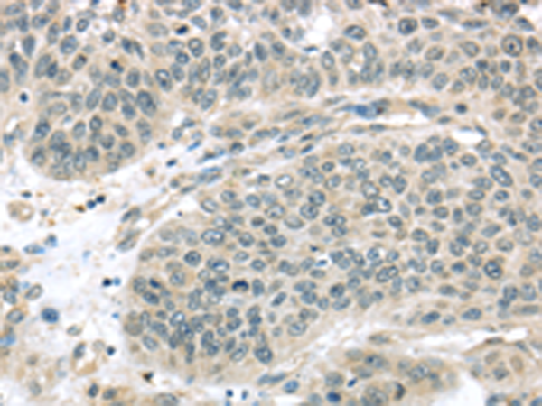 Anti-THAP4 Rabbit Polyclonal Antibody