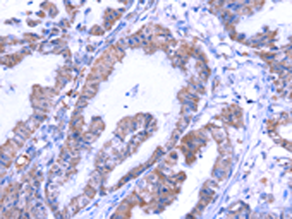Anti-THRSP Rabbit Polyclonal Antibody