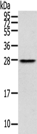 Anti-Thymocyte nuclear protein 1 Rabbit Polyclonal Antibody
