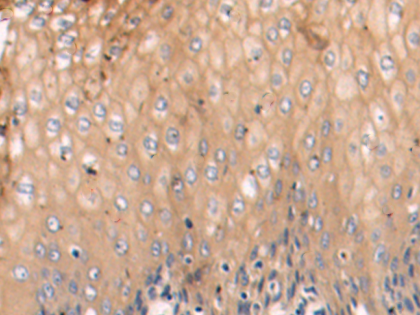 Anti-TRIM14 Rabbit Polyclonal Antibody