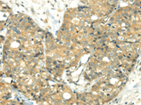 Anti-TRIM10 Rabbit Polyclonal Antibody