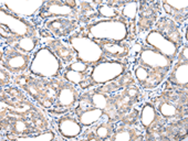 Anti-TIMM17A Rabbit Polyclonal Antibody
