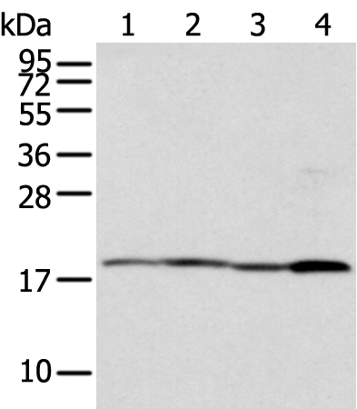 Anti-TIMM17A Rabbit Polyclonal Antibody