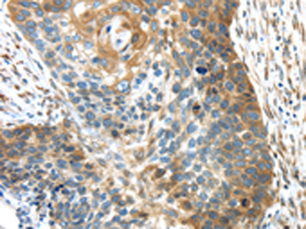Anti-TMED4 Rabbit Polyclonal Antibody
