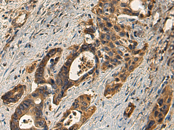 Anti-Transmembrane Protease Serine 11D Rabbit Polyclonal Antibody