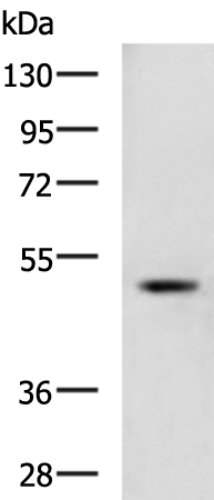 Anti-Transmembrane Protease Serine 11D Rabbit Polyclonal Antibody