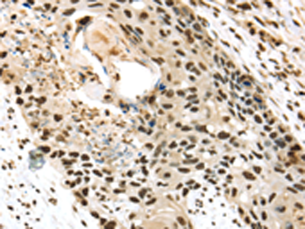 Anti-Transaldolase Rabbit Polyclonal Antibody