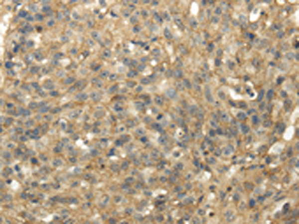 Anti-TACSTD2 Rabbit Polyclonal Antibody