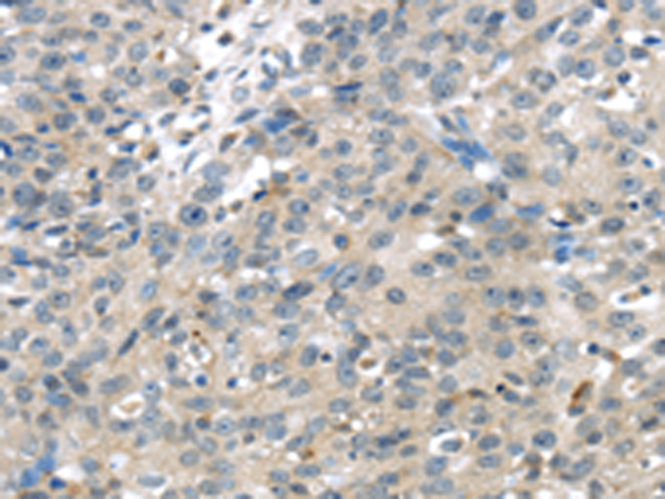 Anti-TRPM2 Rabbit Polyclonal Antibody