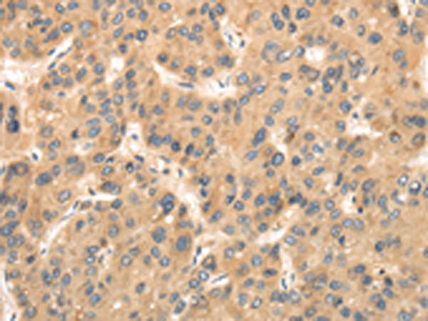 Anti-TPR Repeat Protein 23 Rabbit Polyclonal Antibody