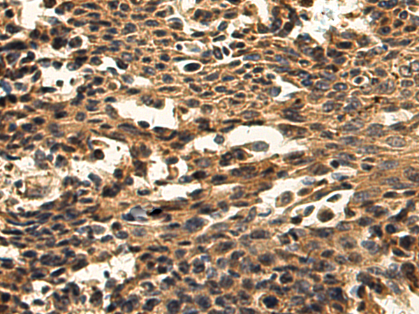Anti-DNAJB11 Rabbit Polyclonal Antibody