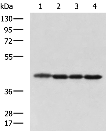 Anti-DNAJB11 Rabbit Polyclonal Antibody