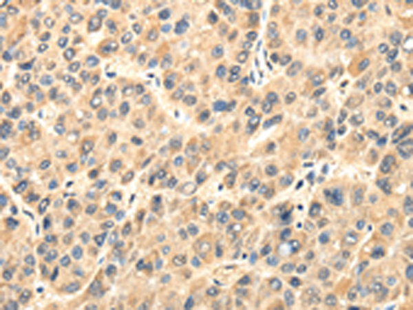 Anti-TWIST2 Rabbit Polyclonal Antibody
