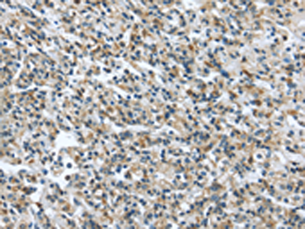Anti-ER Protein 44 Rabbit Polyclonal Antibody