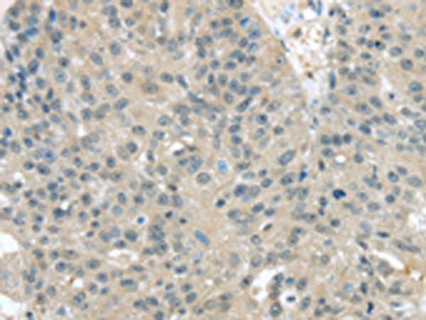 Anti-Thioredoxin Domain Containing Protein 17 Rabbit Polyclonal Antibody
