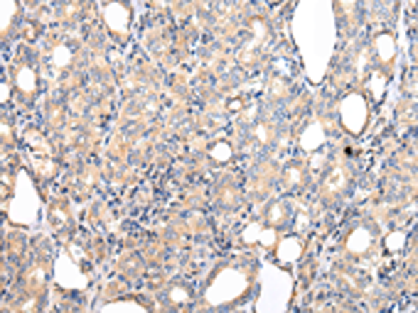 Anti-PPP5C Rabbit Polyclonal Antibody