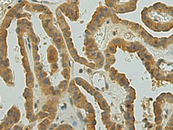 Anti-UGT2B4 Rabbit Polyclonal Antibody