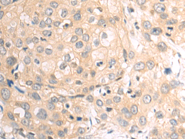 Anti-STRAP Rabbit Polyclonal Antibody